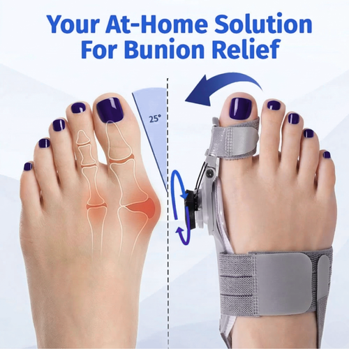 Kevora™ Bunion Fix