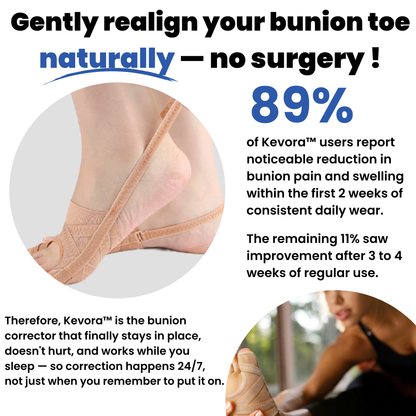 Kevora™ Bunion Corrector