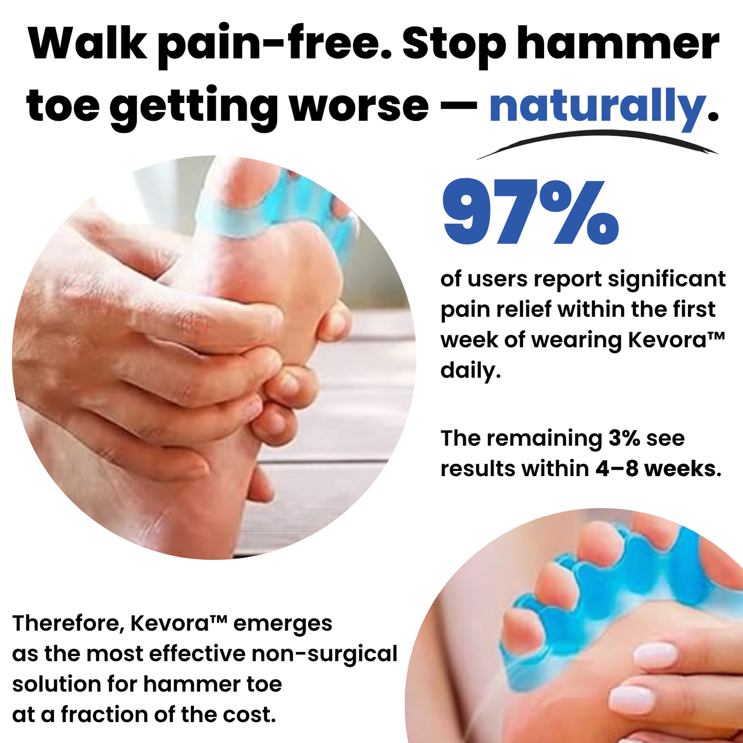 Kevora™ Hammer Toe Corrector