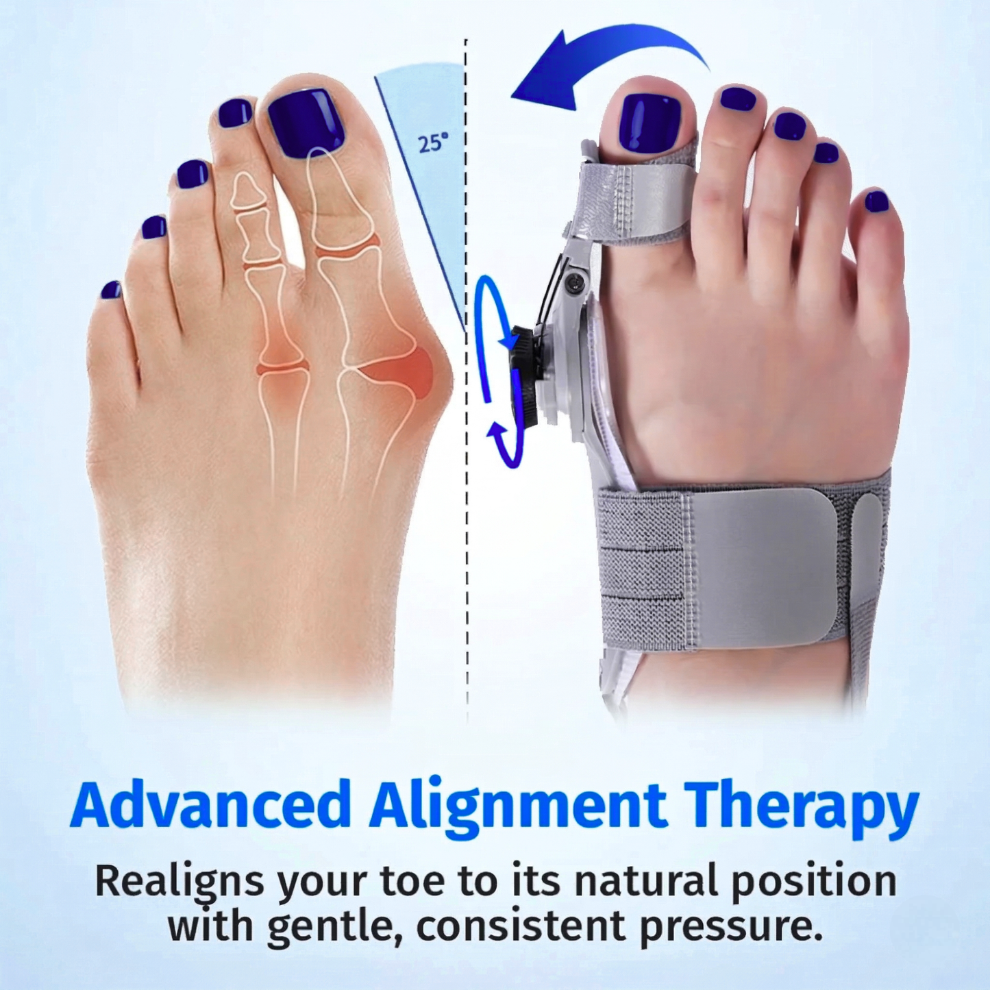 Kevora™ Bunion Fix