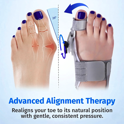 Kevora™ Bunion Fix