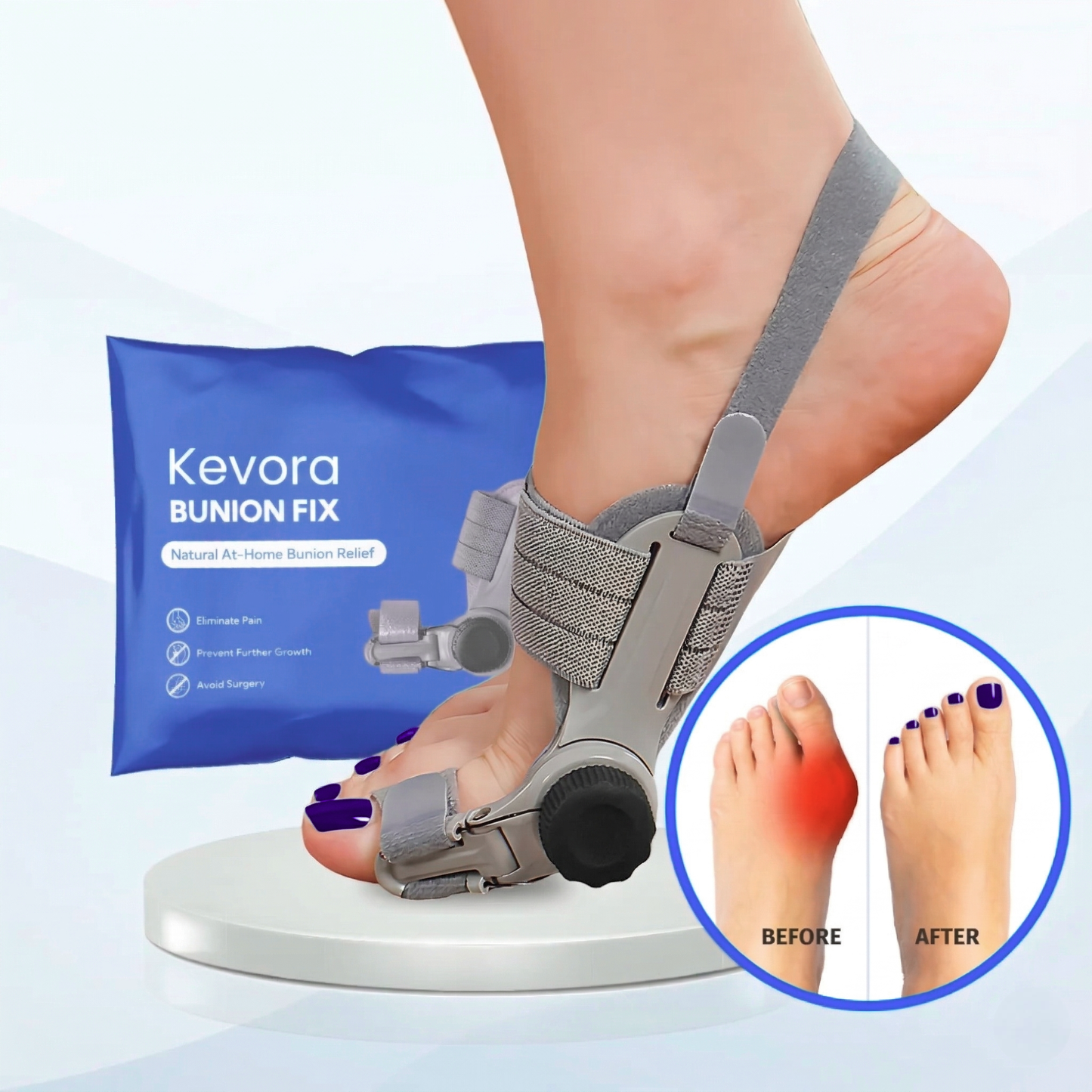 Kevora™ Bunion Fix