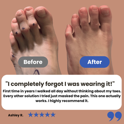 Kevora™ Hammer Toe Corrector Fabric Buddy Wraps