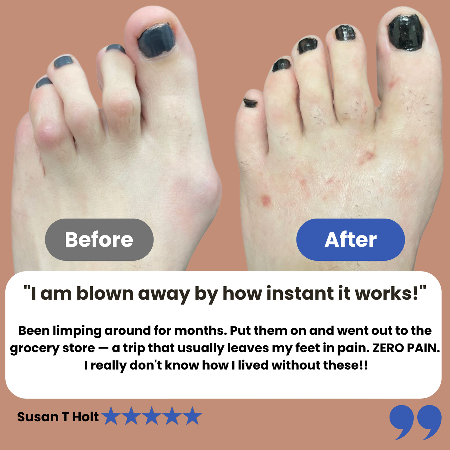 Kevora™ Hammer Toe Corrector