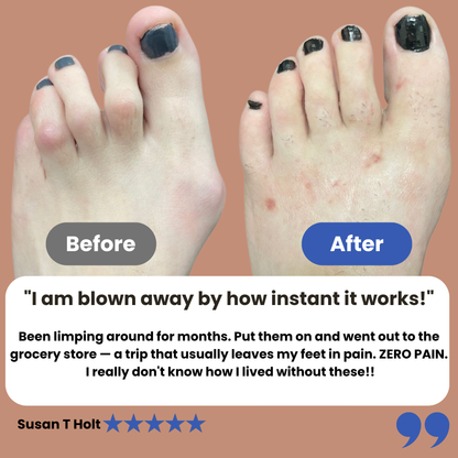 Kevora™ Hammer Toe Corrector