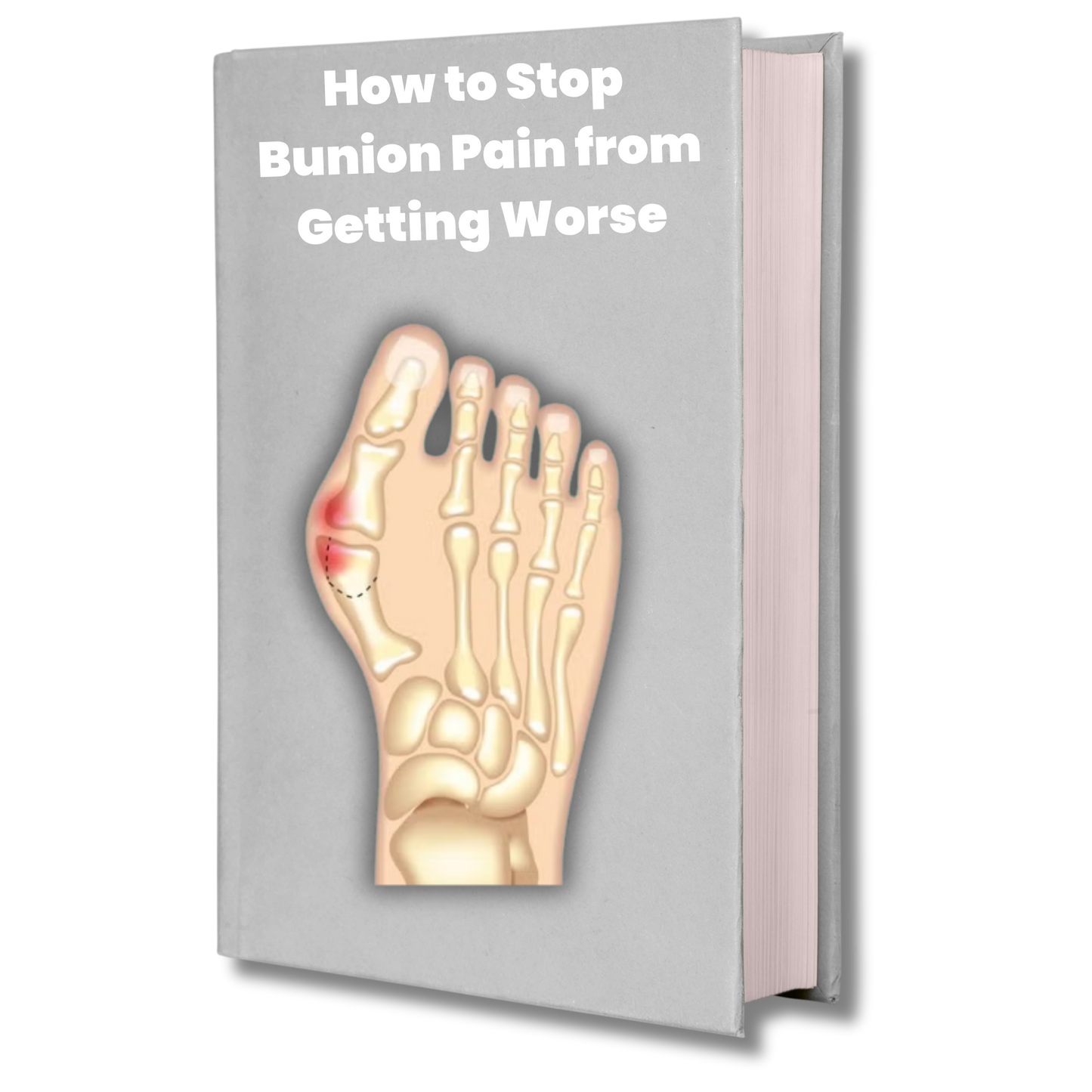 How to Stop Bunion From Getting Worse