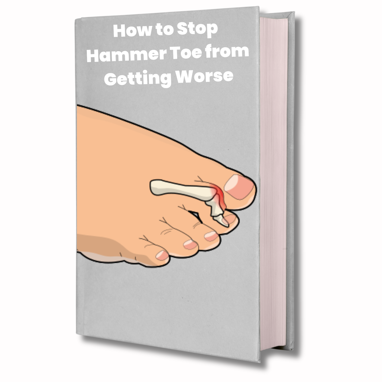 How to Stop Hammer Toe from Getting Worse