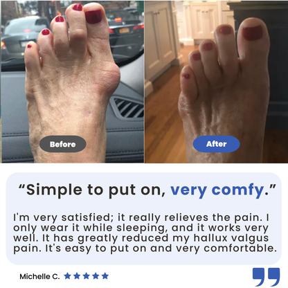 Kevora™ Bunion Fix