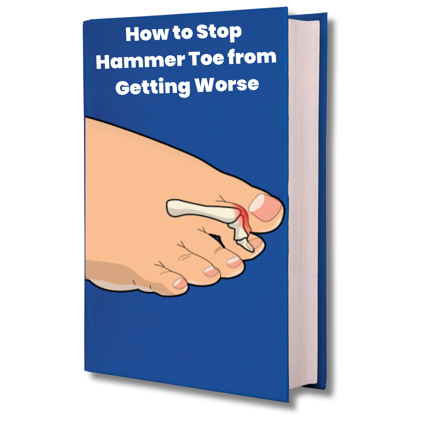 How to Stop Hammer Toe from Getting Worse