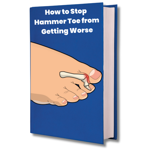 How to Stop Hammer Toe from Getting Worse